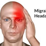 Migraine